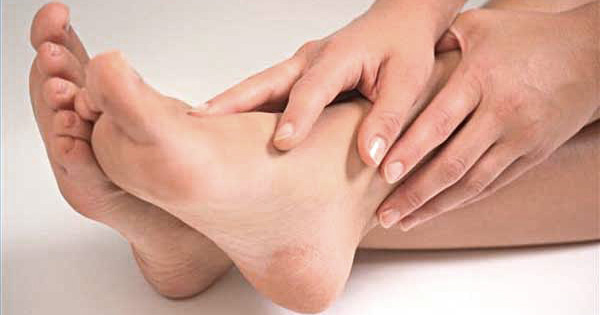 Cracked Heels Remedies in Hindi